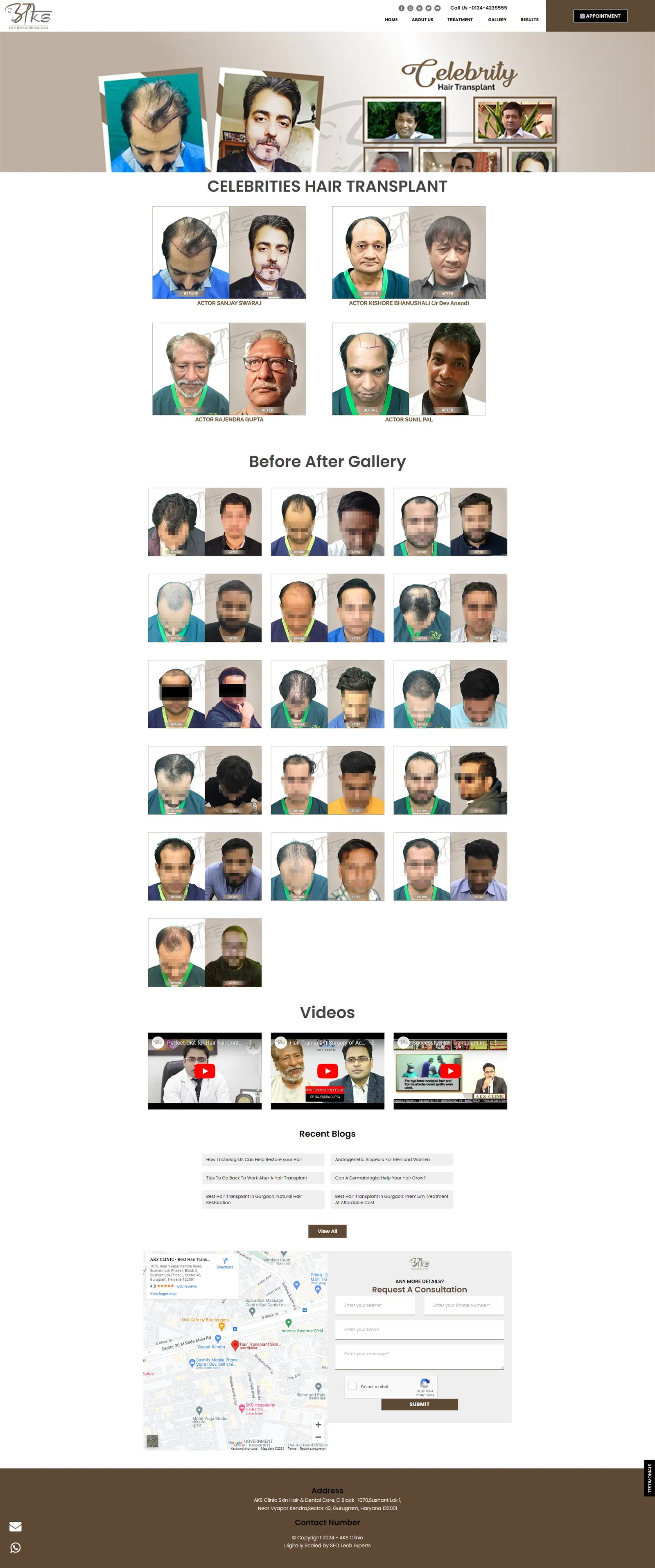 directhairtransplant-in-before-and-after directhairtransplant-in-before-and-after